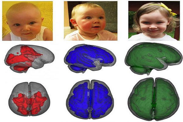 Бебиња и мозоци