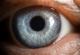 Мрежницата на окото може да покаже колку е здрав вашиот мозок
