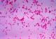 Инвазивни бактерии можеби предизвикуваат ендометриоза, покажува истражување