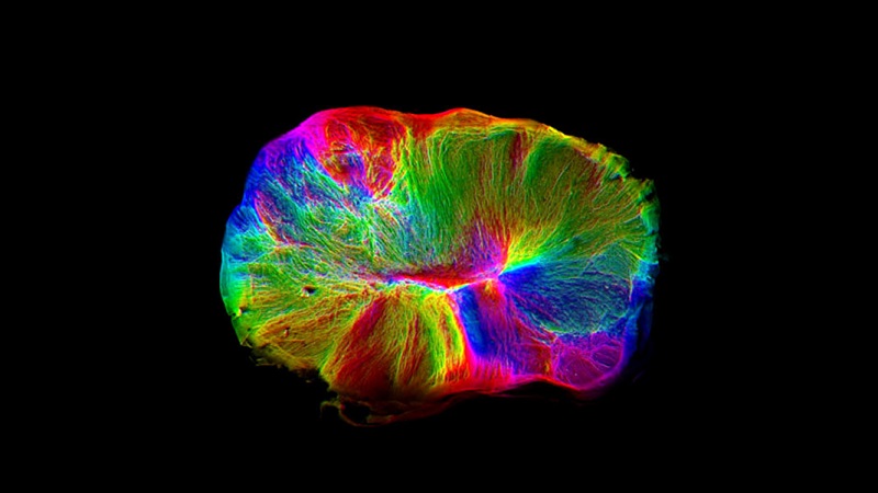 Лабораториски мозок контролира 'рбетен мозок
