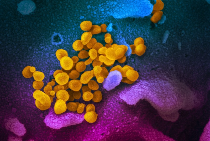 Смртоносниот коронавирус снимен под електронски микроскоп