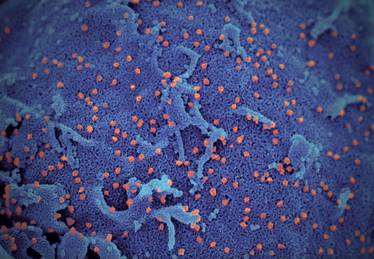 Што му прави коронавирусот на телото - орган по орган