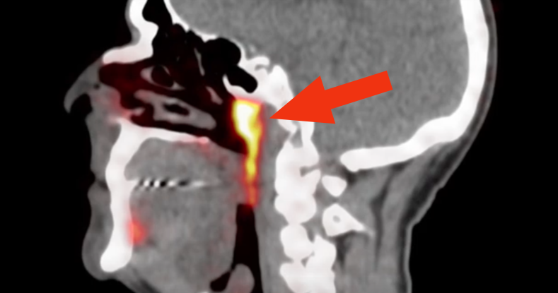Научници открија орган во центарот на човечката глава