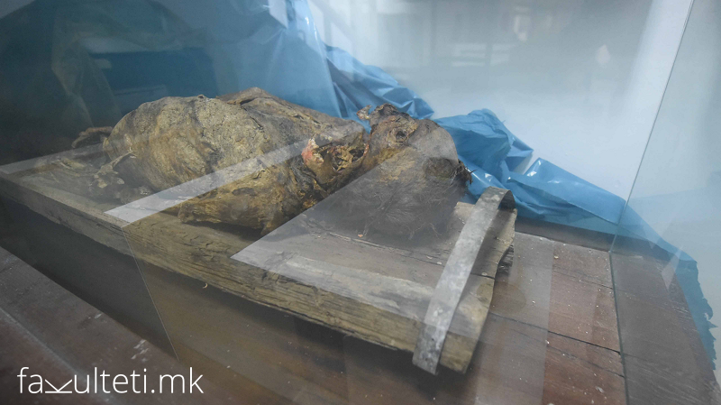 Органи, коски, фетуси, но и мумијата од Липково ќе бидат дел од обновената музејска поставка на Институтот за судска медицина