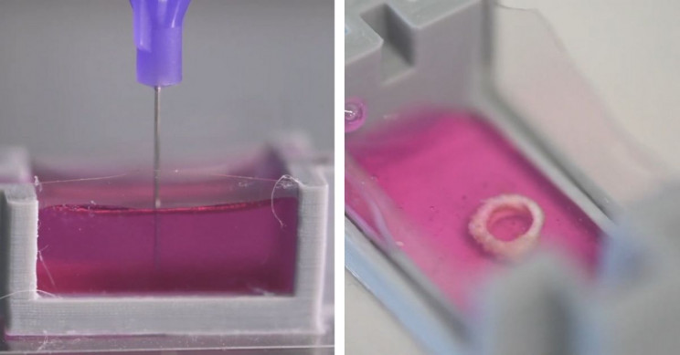 Наскоро ќе може да се печатат коски директно во човечкото тело?