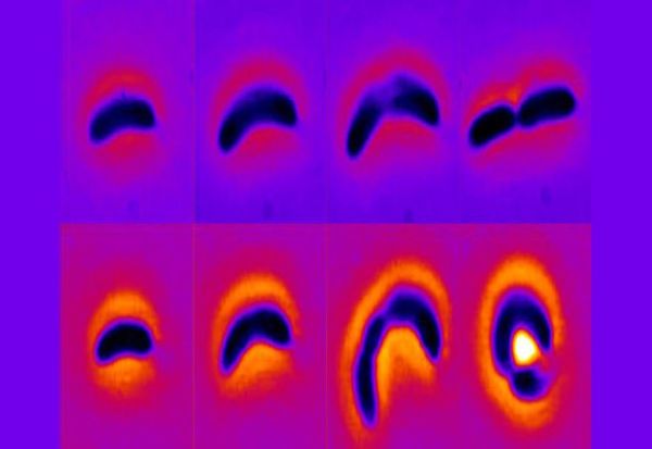 Фотографија покажува како бактериите ги избегнуваат антибиотиците