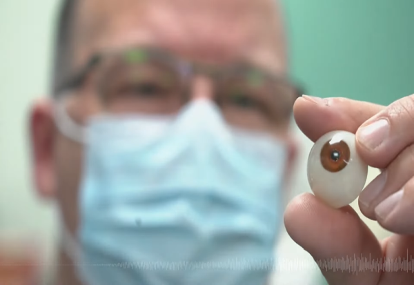 Британец го доби првото 3Д-печатено око