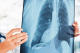 Aерозагадувањето и пушењето најчести причини за хронична опструктивна белодробна болест