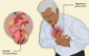 Срцева слабост, астма, дијабетес – листа на хроничните болести ризични за коронавирус