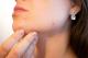 Дисебореа, акни и розацеа - три најчести промени на лицето