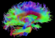 Најдеталната мапа на „мемориската банка“ на мозокот открива нешто изненадувачко