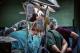 Првпат во Македонија експлантирани четири органи од еден дарител во еден акт